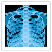 Émoji 🩻 Radiographie sur Apple iOS 15.4.