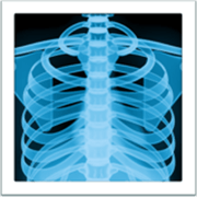 Émoji 🩻 Radiographie sur Apple iOS 17.4.