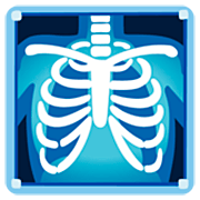 Émoji 🩻 Radiographie sur Google 15.0.
